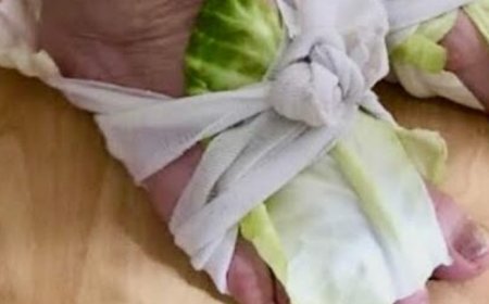 Cabbage Wraps: A Simple Remedy for Swollen Joints and Thyroid Issues