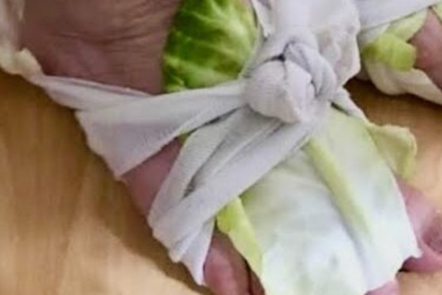 Cabbage Wraps A Simple Remedy for Swollen Joints and Thyroid Issues