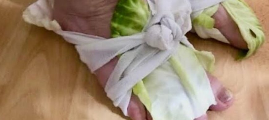 Cabbage Wraps: A Simple Remedy for Swollen Joints and Thyroid Issues