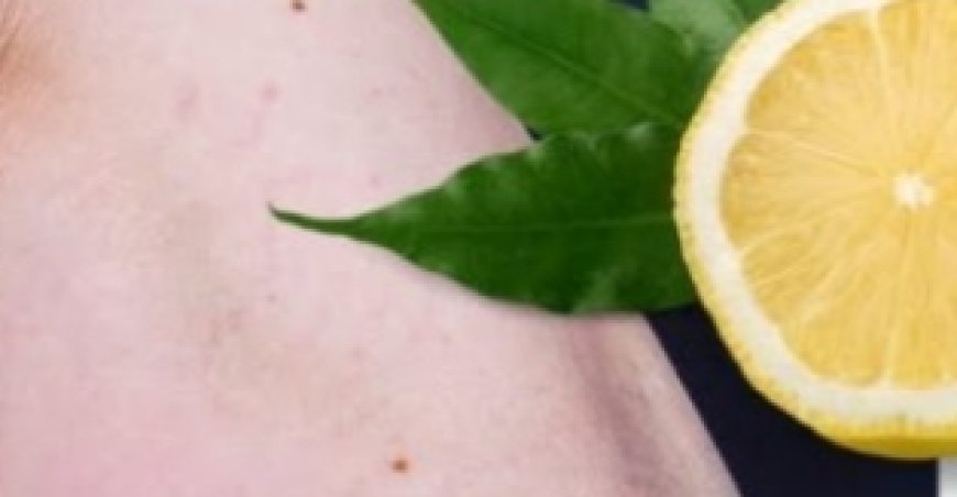 Lemon Removes Varicose Veins! Just Do This Every Day…