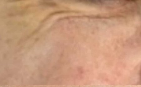 The Surprising Benefits of a Toothpaste and Egg Facial Mask