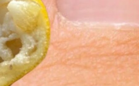 100% No Fungi on Nails! Natural Therapy for Healthy and Shiny Nails Using Lemon and Salt