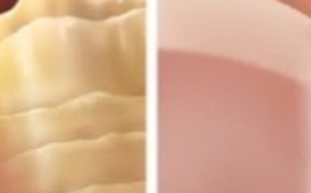 Solve Nail Fungi 100% Naturally: Healthy and Shiny Nails with Vinegar