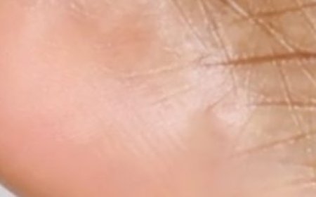 How to Remove Dead Skin Cells from Your Feet in Minutes | Self Care Routine