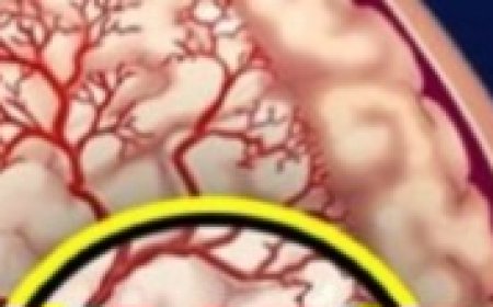 Better Than Aspirin! Ginger Tea Prevents Clots Naturally