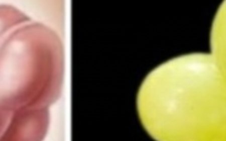 Intestine and Liver Are Like New! Just 3 Days with Grapes – All the Dirt Comes Out