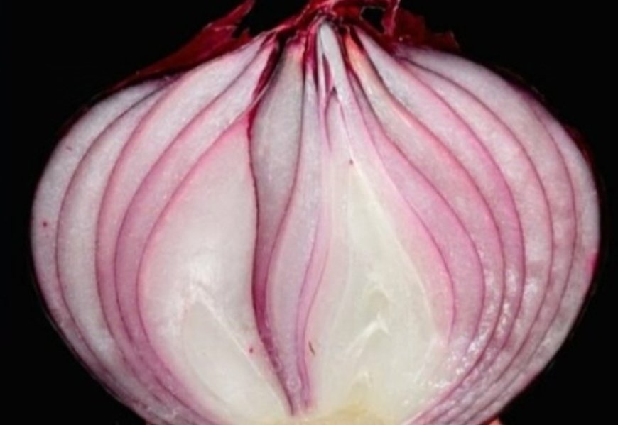 Erases Varicose Veins Like an Eraser! Top 5 Recipes with Red Onion