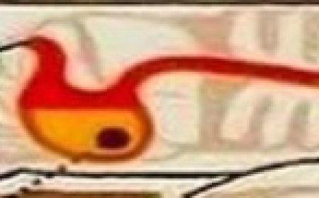 Best Sleeping Position for Acid Reflux and Heartburn