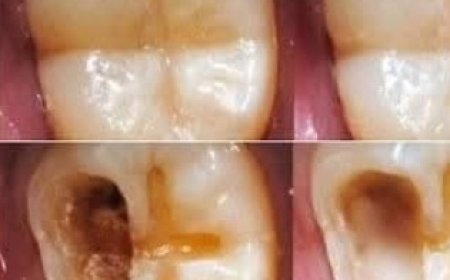 Natural Ways to Maintain Good Dental Health