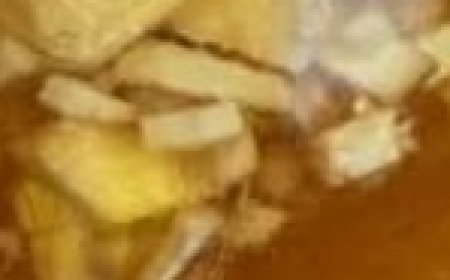 Cholesterol as if it Never Existed: Natural Medicine for Cleaning Blood Vessels