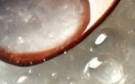 Hair Grows Like Crazy and Stops Falling Out: The Magic of Aloe Vera for Hair