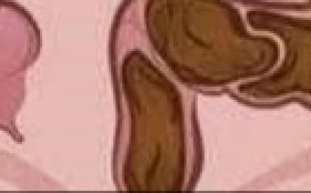 How to Clean Your Colon and Remove Waste Naturally