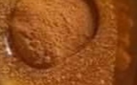 Cinnamon and Honey: A Powerful Remedy Even Doctors Can’t Fully Explain