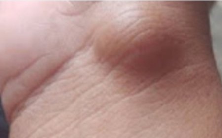 Adipose Tissue: The Body’s Energy Storage System