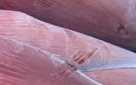 Banana Blossom: Health Benefits, Recipes, and Uses