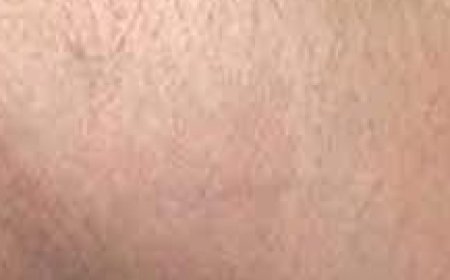 Stop Shaving! Here’s How to Permanently Get Rid of Facial, Body, and Pubic Hair with Natural Ingredients