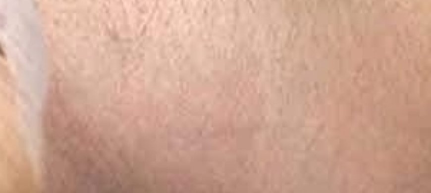 Stop Shaving! Here’s How to Permanently Get Rid of Facial, Body, and Pubic Hair with Natural Ingredients