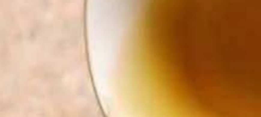 Say Goodbye to Swollen Legs, Ankles & Feet with This Natural Tea!