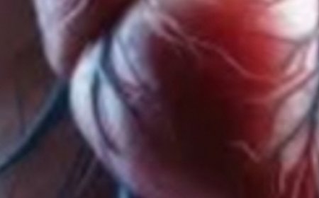 Garlic: The Tiny Ingredient With Big Health Benefits