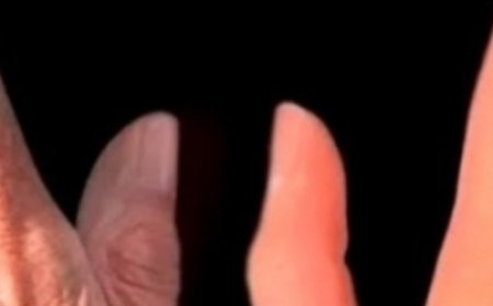 Bay Leaf: A Million Times Stronger Than Botox or Collagen?Smooth Out Wrinkles and Fine Lines Naturally