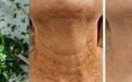 Homemade Mask: Getting Rid of Wrinkles and Spots