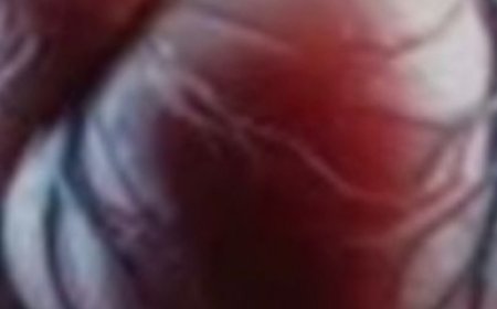 Garlic: The Tiny Ingredient With Big Health Benefits